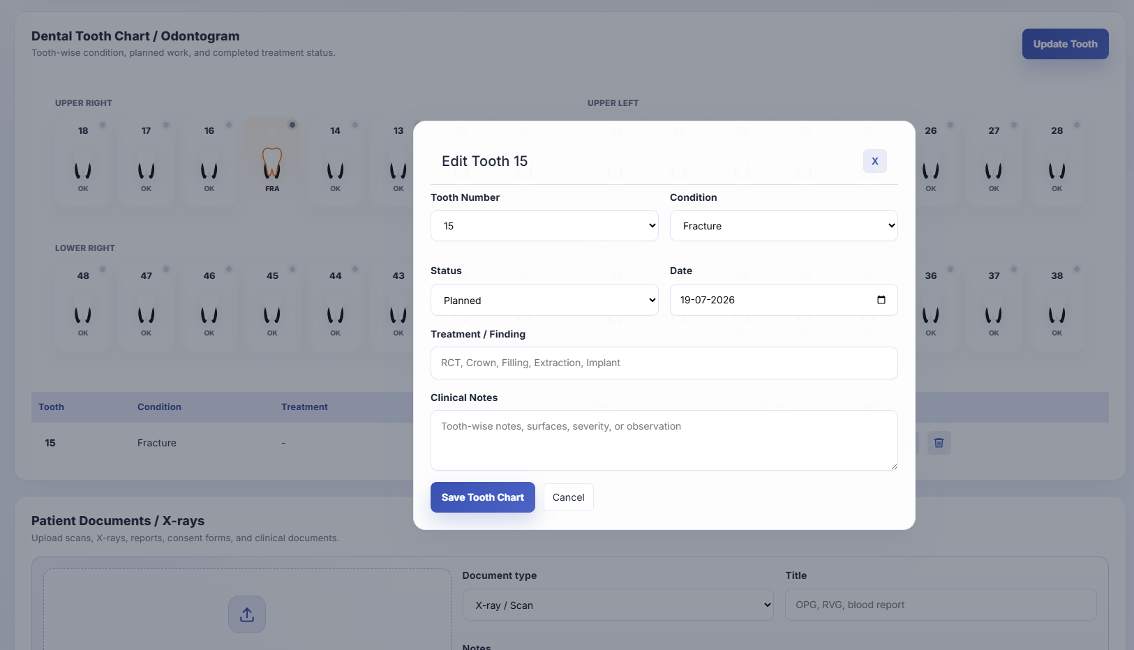 Clinzify dental tooth chart with tooth-wise conditions, planned treatments, and clinical notes